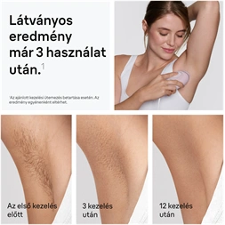 BRAUN Silk-Expert IPL PL1100 villanófényes szőrtelenítő